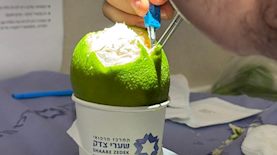 שערי צדק מנתחים פירות